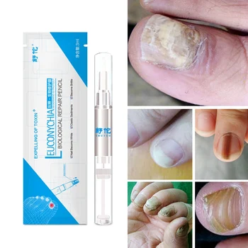 Cumpara online 20g Unghii Îngrijire de Reparare Crema Anti-Ciuperca Unghiilor de la Picior Antifungice Onicomicoza Repararea Promova Creșterea Unghiilor Lumina Unghii | Nails art & instrumente ~ www.magazinuldan.ro 11
